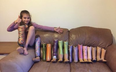 Amputee Family Spotlight with the Haynes Family