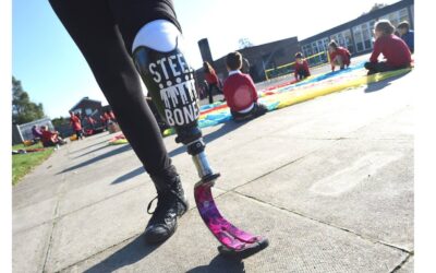 Your First Visit to a Prosthetic Clinic: What to Expect and How to Prepare
