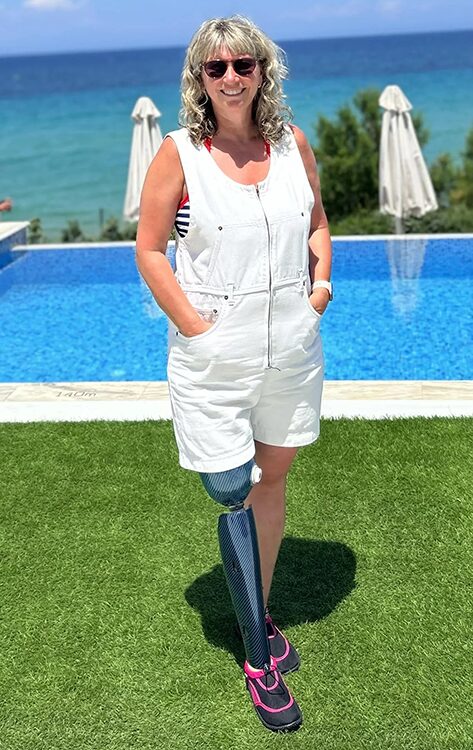 Mandie-Smith Tracy-with-Blue-Leg-web